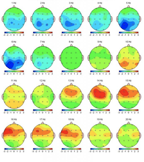 Is Neurofeedback A Sham? How do I know if It's Working?