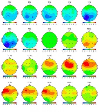 Brain map from a neurofeedback device