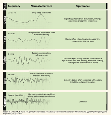 Brainwaves image-1