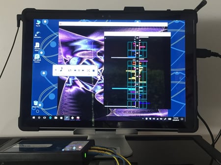 NeurOptimal Neurofeedback device